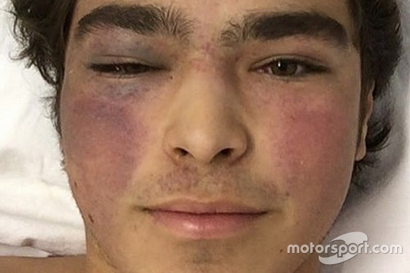 Pedro Piquet segue internado em Goiânia após forte acidente