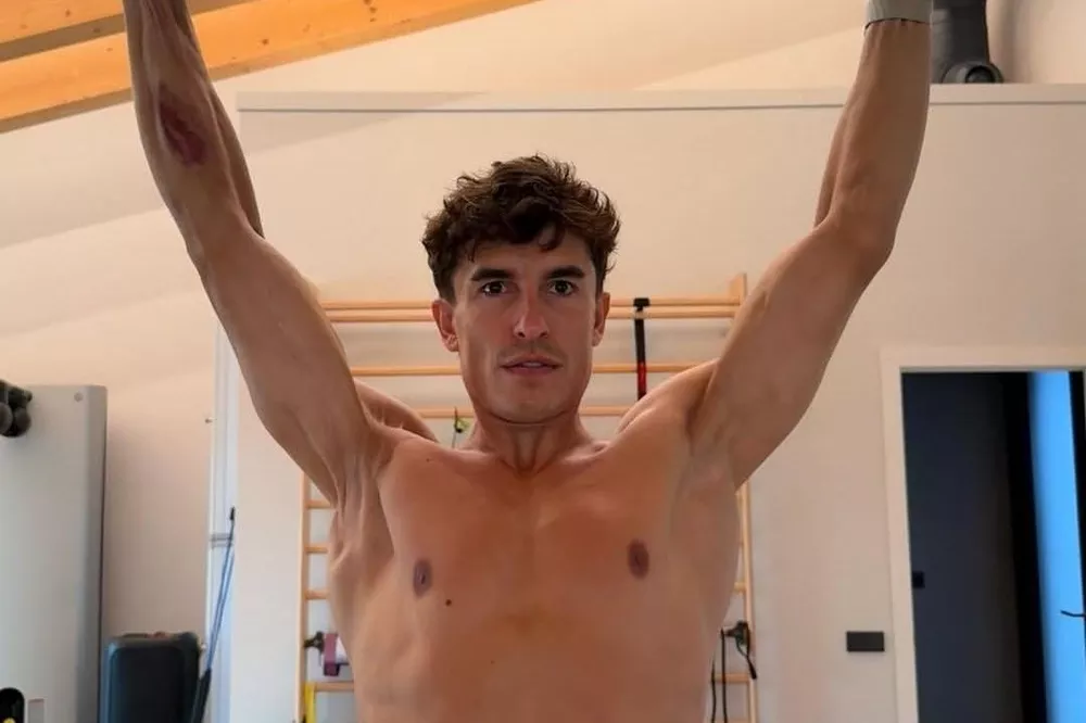 Marc Márquez, brazo derecho, Aragón