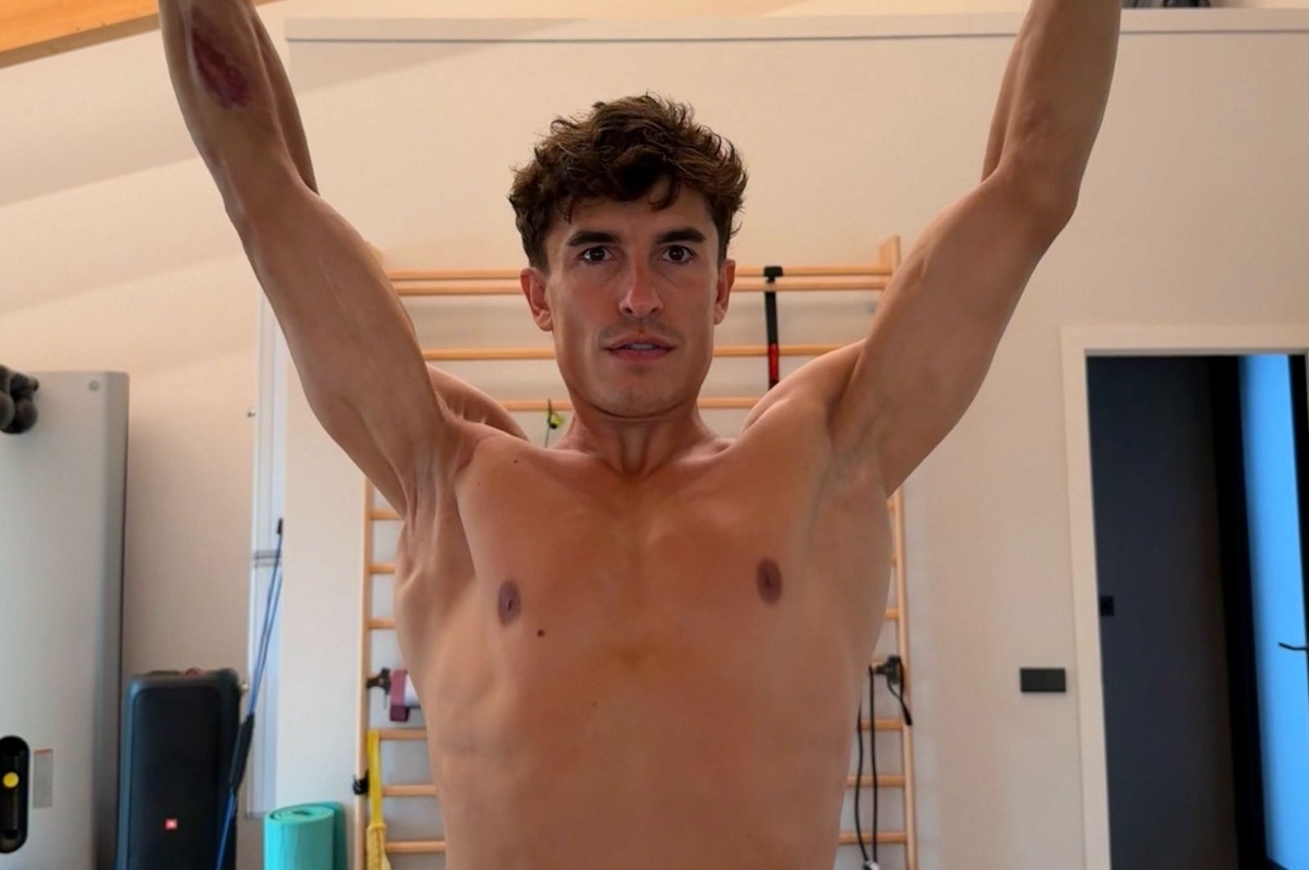 Ce que signifie vraiment la photo du bras de Marc Márquez