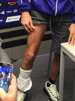 Valentino Rossi montre sa jambe