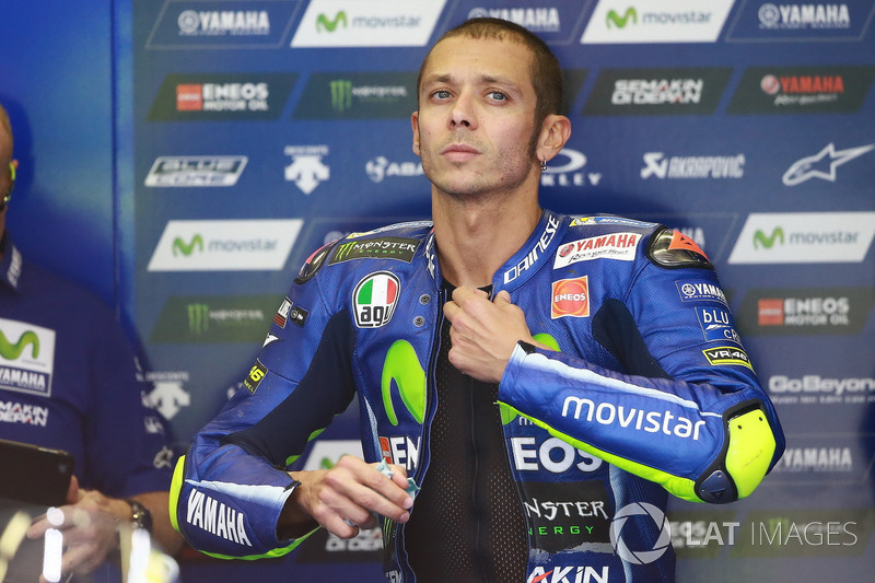 La gamba rotta durante un allenamento di motocross